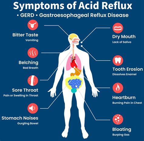 Acidity Reflux Symptoms