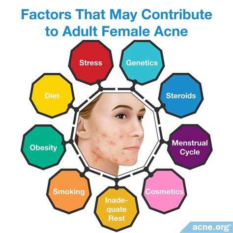 Acne Adult Cause Female