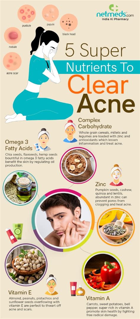 AntiAcne Food Eat Healthy To Heal Acne Infographic