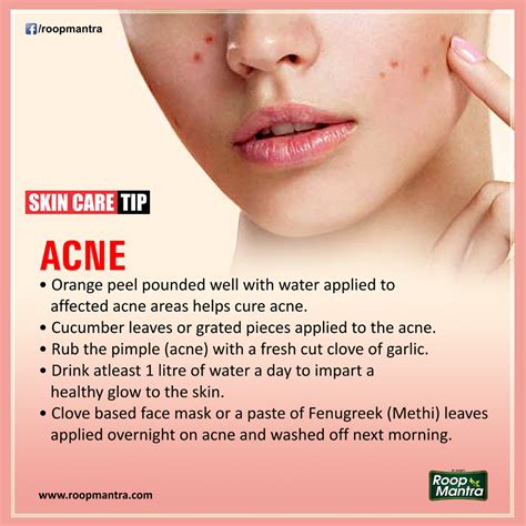Health Tips For Living Health Tips for Women Acne Skin Care