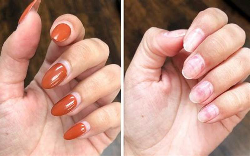 Acrylic Nails Removal Progress