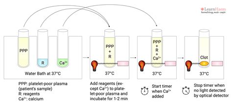 Activated Partial Thromboplastin Time Test and interpretation