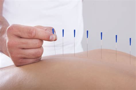 Acupuncture: Relief & Wellness During Pregnancy.