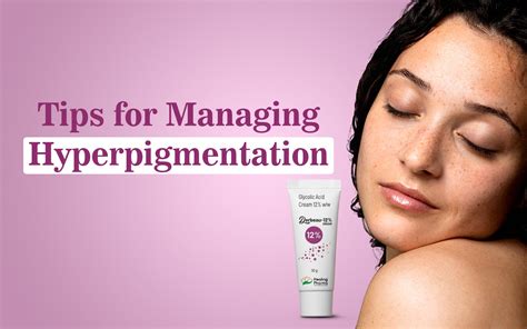 Additional Tips for Managing Hyperpigmentation