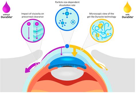 Addressing Complex Ophthalmic Issues