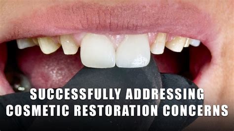 Addressing Cosmetic Concerns