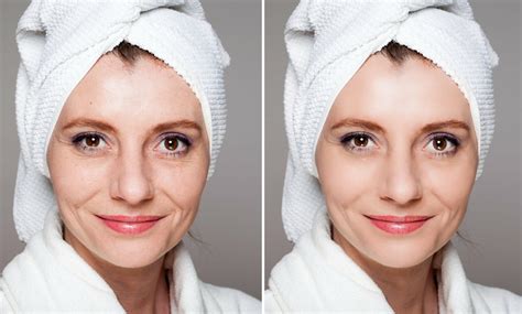 Addressing Specific Blonde Concerns