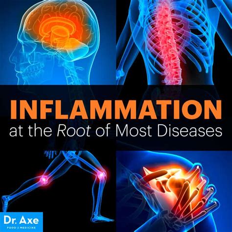 Addressing the Root Cause (Inflammation)