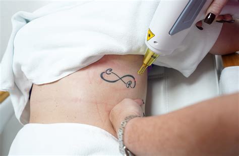 Addressing the tattoo problem