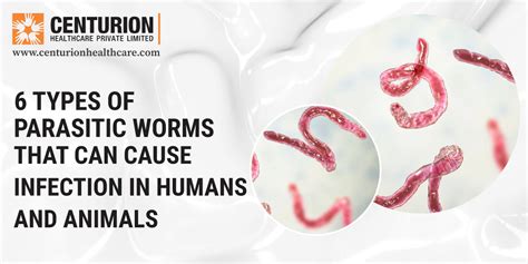 Adult Worm Infections: Types & Solutions