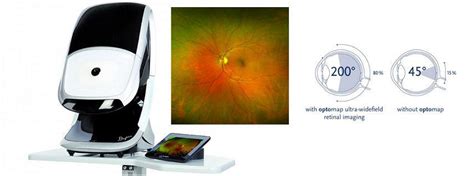 Advanced Eye Exam Technology