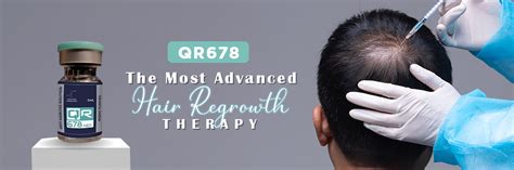 Advanced Procedures for Hair Regrowth