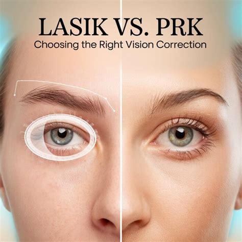 Advanced Vision Correction (LASIK and PRK)