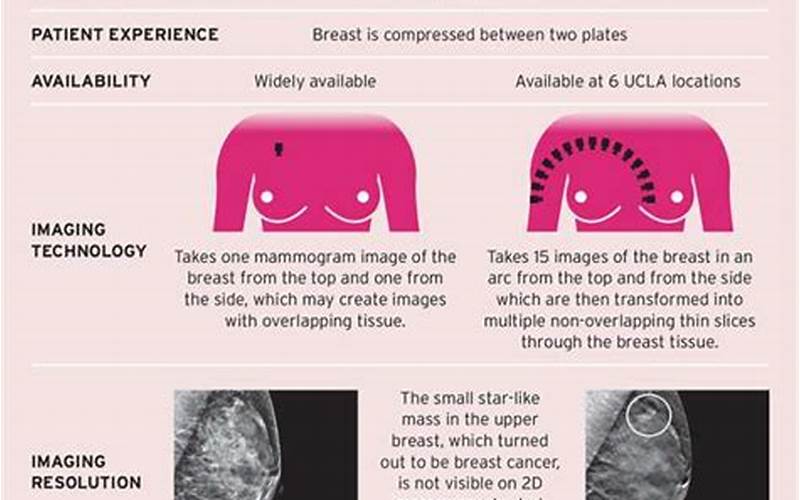 Advantages Of Breast Tomosynthesis