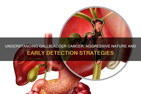 Aggressive Nature and Rapid Progression