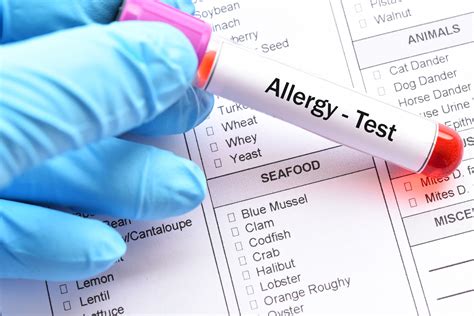 Allergy Screening Panel Test and interpretation