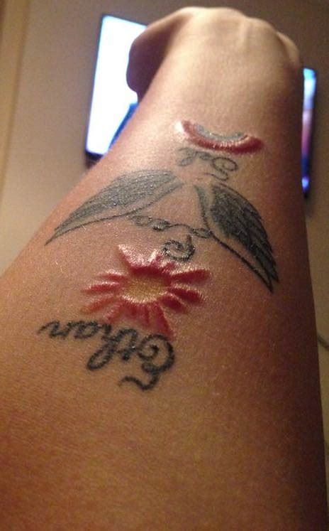 Allergy To Red Tattoo Ink