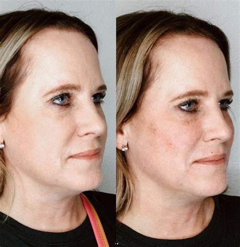 Allure Skin & Laser Center