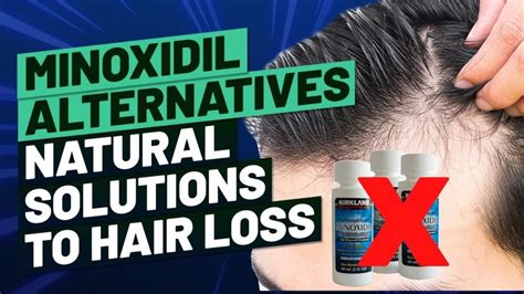 Alternatives to Minoxidil