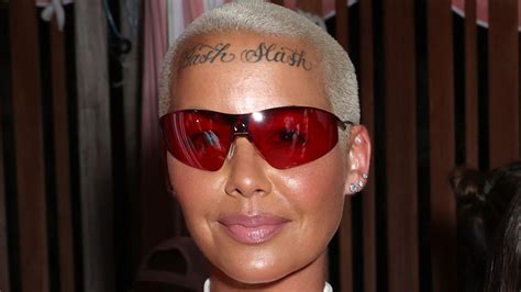 Amber Rose Forehead Tattoo Removal