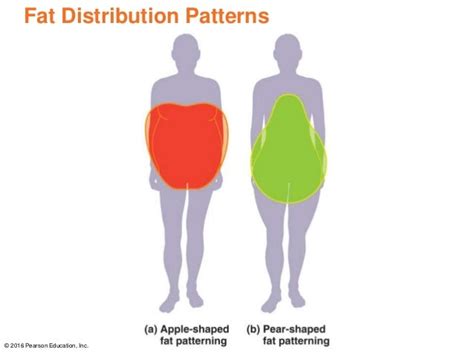 An Apple Shaped Fat Pattern Increases A Person's Risk For