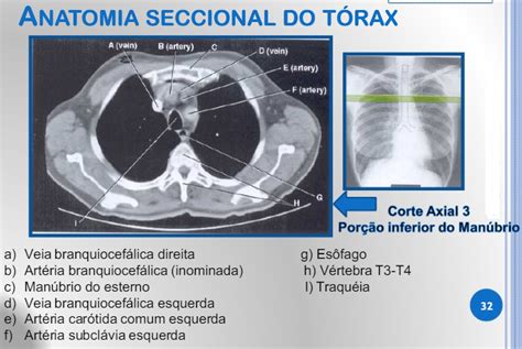 Seccional Do