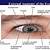 Anatomy Of External Eye