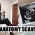 Anatomy Scan 18 Weeks