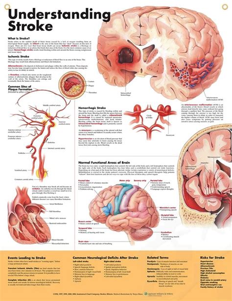 Anatomy of Stroke Evaluation