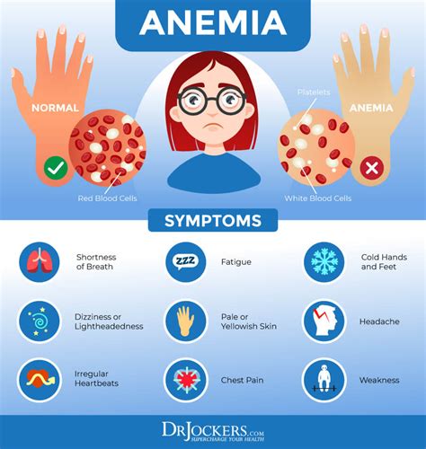Anemia Causes