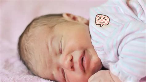 Anemia Pada Bayi