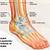 Ankle Ligaments Tear