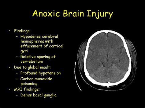 Unlocking the Mystery: A Comprehensive Guide to Anoxic Brain Injury Definition and its Impact on Lives