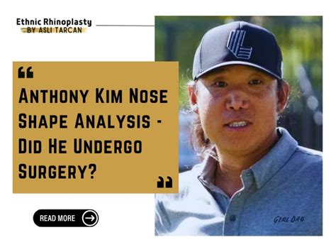 Anthony Kim Nose | Comprehensive Overview