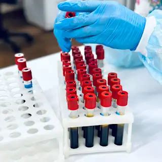 Antibody Testing: The T1D Confirmation