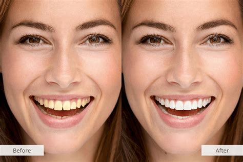 Transform Your Smile Instantly: The Best App to Fix Teeth in Pictures
