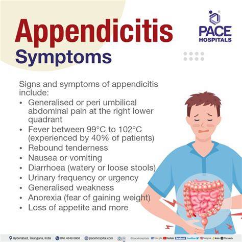 Appendicitis: Symptoms & Fast Treatment Options
