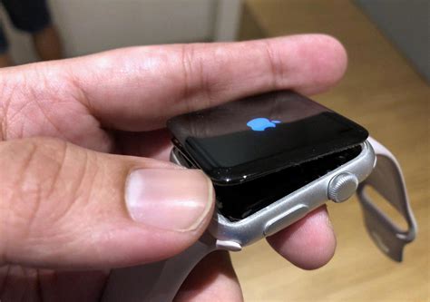 Screen shatters no more: Discover the unbeatable Apple Watch screen replacement cost