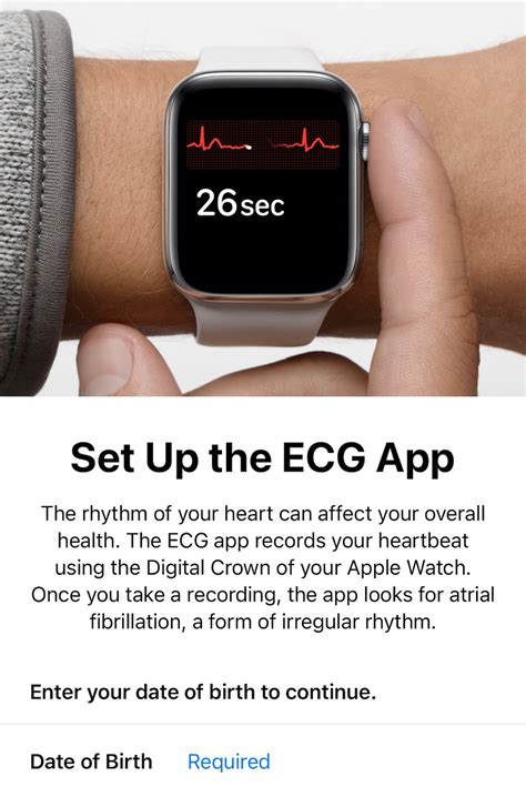 Apple Watch models that support ECG
