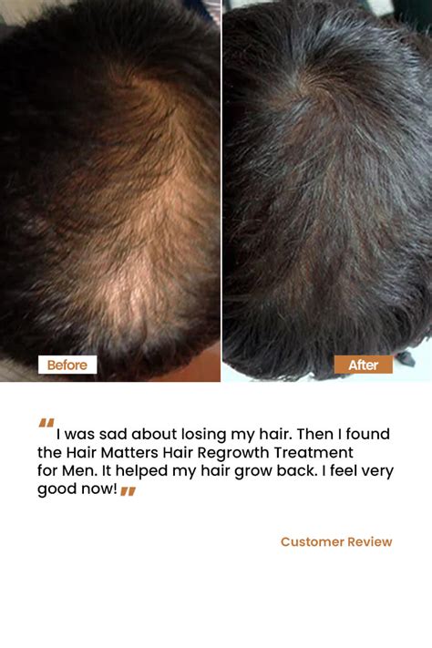 Application Matters: How to Use Your Regrowth Oil Effectively