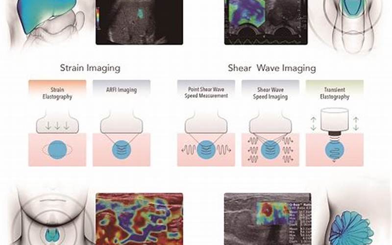Applications Of Elastography