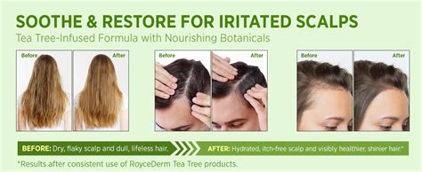 Practical Application: How to Use Tea Tree Oil For Scalp Effectively