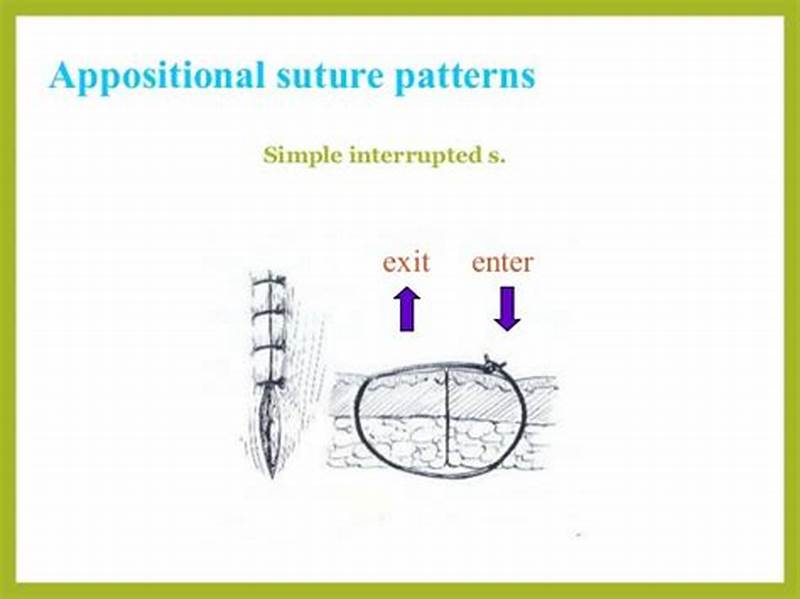 Appositional Suture Pattern