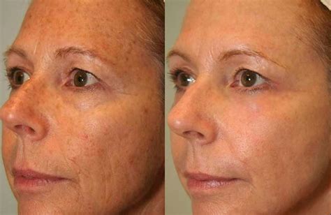 Revitalize Your Skin with Arizona Skin and Laser!