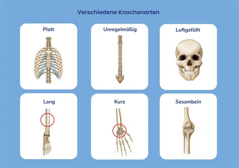 Arten
