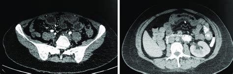 Penjelasan Asas Delgadas: Kelebihan dan Cara Mengatasi Masalah Kelebihan Berat Badan