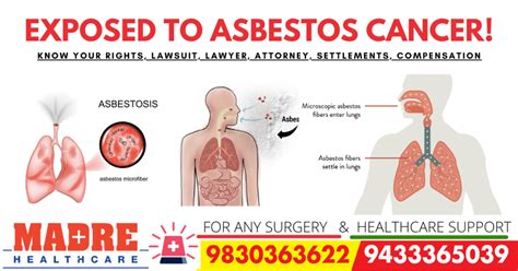 Asbestos Cancer Attorney