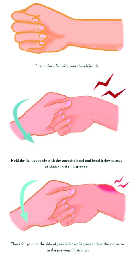 Assess Your Hand