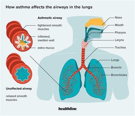 Asthma & COVID-19: Understand Your Risk Now.