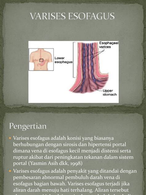 Atasi Varises Esofagus: Penanganan & Obat Efektif